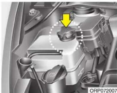 KIA Carens (2015) - Entretien - 1