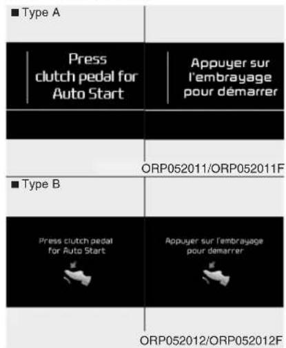 KIA Carens (2015) - Redémarrage auto moteur - 1