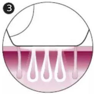 PHILIPS Lumea Advanced BRI921 - Principe de fonctionnement de la lumière pulsée intense - 3