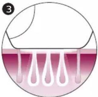 PHILIPS Lumea Advanced BRI921 - How IPL works - 3