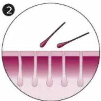 PHILIPS Lumea Advanced BRI921 - How IPL works - 2