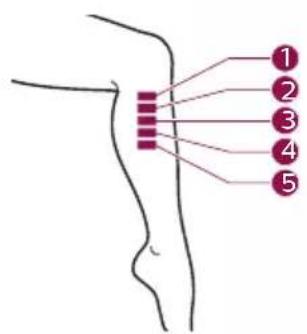 PHILIPS Lumea Advanced BRI921 - B Test skin 24 hours before treatment - 9