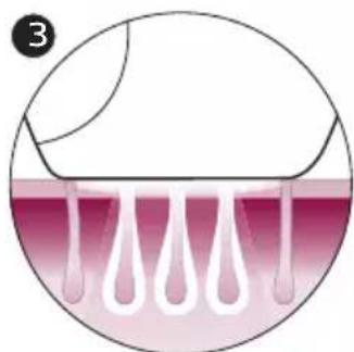 PHILIPS Lumea Advanced BRI920 - How IPL works - 3