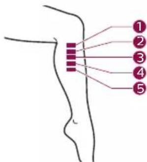 PHILIPS Lumea Advanced BRI920 - B Test skin 24 hours before treatment - 8