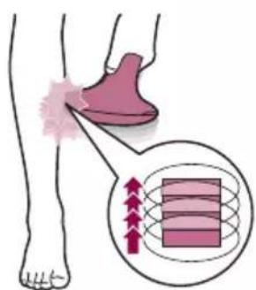 PHILIPS Lumea Advanced BRI920 - Two treatment modes: Stamp & Flash and Flash - 2