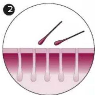 PHILIPS Lumea Advanced BRI920 - How IPL works - 2