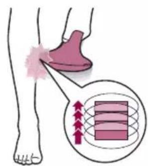PHILIPS Lumea Advanced BRI920 - C Treatment - 5