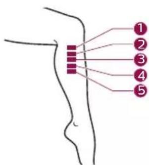 PHILIPS Lumea Advanced BRI920 - B Realiza una prueba sobre la piel 24 horas antes de tratamiento - 8