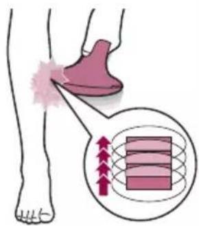 PHILIPS Lumea Advanced BRI920 - Deux modes de traitement : positionner-flasher glisser-flasher - 2