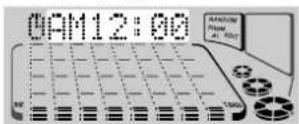 AIWA XHA1000 - Preparation - 4