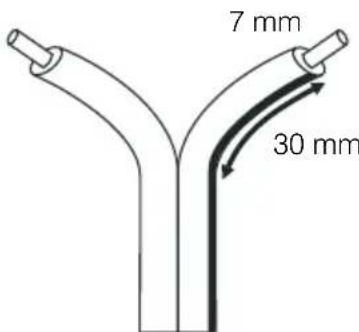Q-ACOUSTICS 3000i - Preparing Cables - 1