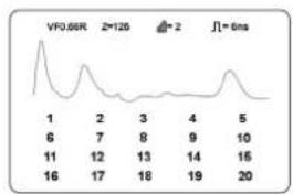 Megger TDR2050 - Enregistrement de la trace en cours - 3