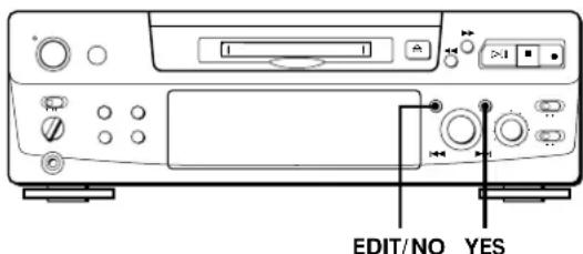 SONY MDSS38 - Annulation de la dernière opération de montage (fonction UNDO) - 1
