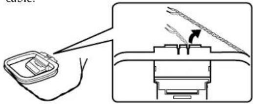 SONY STS3000ES - Que se necessities? - 2