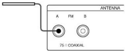 SONY STS3000ES - Que se necessitiesa? - 3