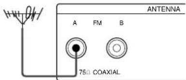 SONY STS3000ES - Que se necessitiesa? - 4