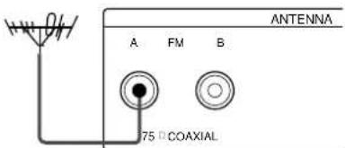 SONY STS3000ES - What will I need? - 4