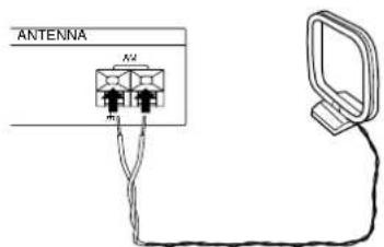 SONY STS3000ES - Was wird benötigt? - 4