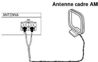 SONY STS3000ES - De quoi avez-vous besoin? - 4
