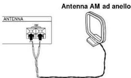 SONY STS3000ES - Elementi necessari - 3