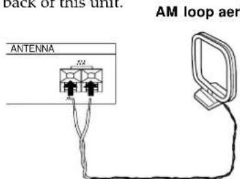 SONY STS3000ES - What will I need? - 4