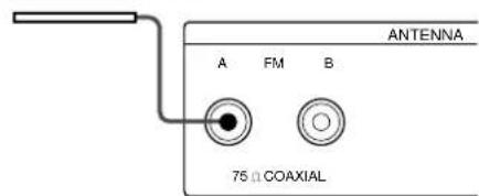 SONY STS3000ES - Was wird benötigt - 3