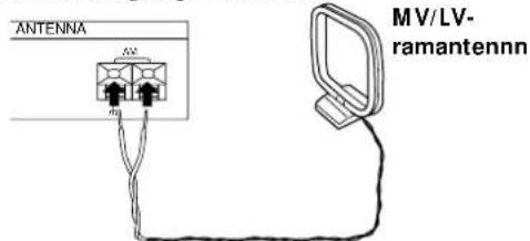 SONY STS3000ES - Vilka tillbehör kravs det? - 4