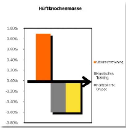 DKN XG5 - ▶ Langzeiteffekt von Vibrationstraining - 2