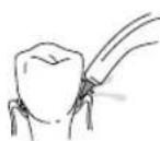 Waterpik WP562E - Orthodontic Tip - 1