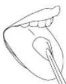 Waterpik WP562E - Orthodontic Tip - 3