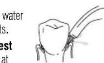 Waterpik WP560E - Orthodontic Tip - 2