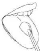 Waterpik WP560E - Orthodontic Tip - 4