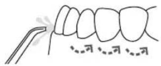 Waterpik WP560E - Iégèrement les lèvres pour - 1