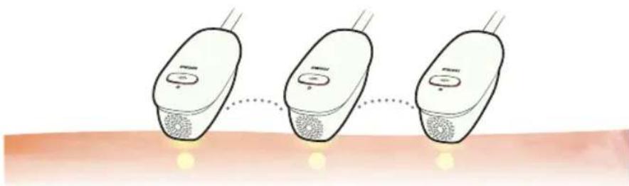 HOMEDICS Duo Salon - Tto taokoe npoedypa AFT FreeGlide n o6pa60TKa OINHOHbIMNMMyIbcamn? - 2