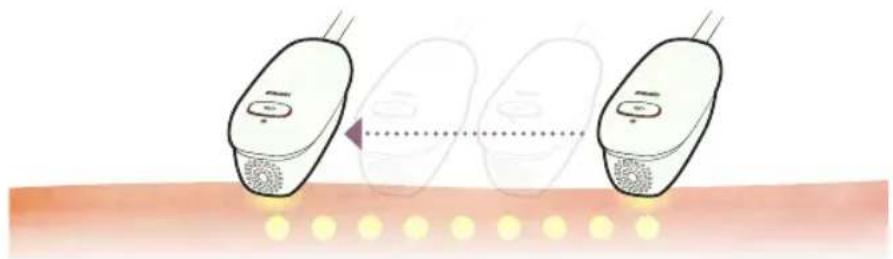 HOMEDICS Duo Salon - Che casa sono i trattamenti AFT FreeGlide e Single Pulse? - 1