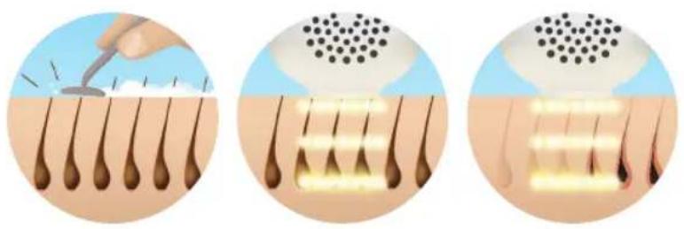 HOMEDICS Duo Salon - Iodrotobka o6pa6aTbIbAmoro yuctka - 1