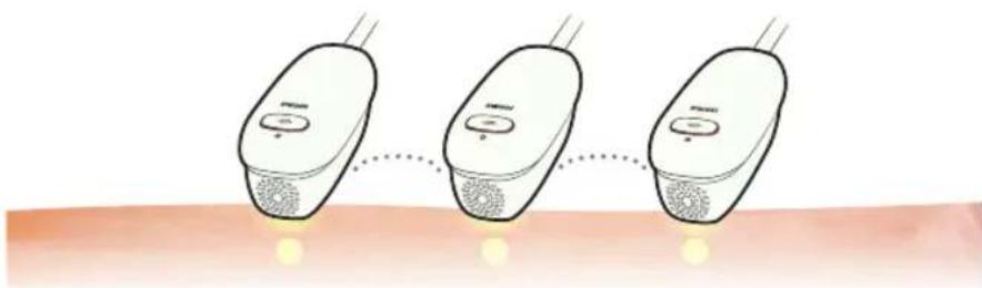 HOMEDICS Duo Salon - What are AFT FreeGlide and Single Pulse treatments? - 2