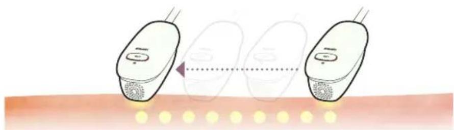 HOMEDICS Duo Salon - En quoi consistent lestraitements par AFT FreeGlide et Impulsion lumineuse individuelle? - 1