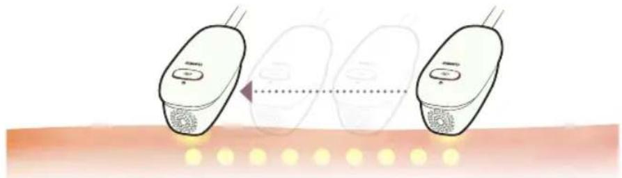 HOMEDICS Duo Salon - What are AFT FreeGlide and Single Pulse treatments? - 1
