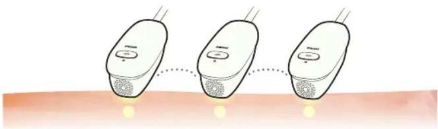 HOMEDICS Duo Salon - Was sind AFT FreeGlide und Single Pulse Behandlungen? - 3