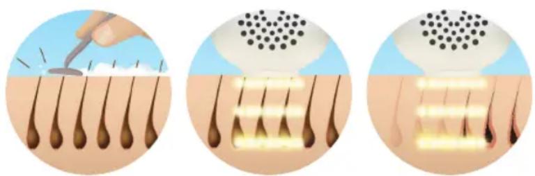 HOMEDICS Duo Salon - Preparar aarea atratar - 1