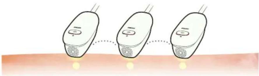 HOMEDICS Duo Salon - En quoi consistent lestraitements par AFT FreeGlide et Impulsion lumineuse individuelle? - 2