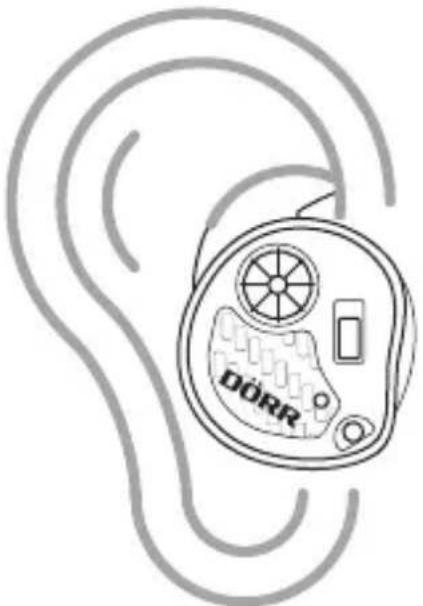 Dörr EDirect GS25 - Trasduttore auricolare correttamente inserto - 2