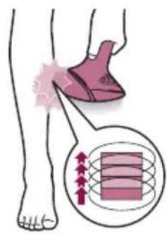 PHILIPS Lumea Prestige BRI949 - Doisemodesdetramento:Pousare pulsare Deslizarepulsar - 2