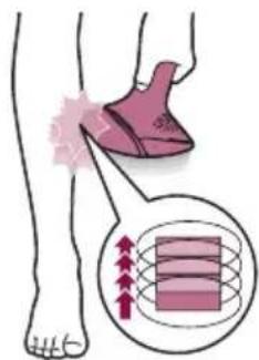 PHILIPS Lumea Prestige BRI949 - Two treatment modes: Stamp & Flash and Slide & Flash - 2