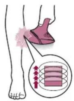 PHILIPS Lumea Prestige BRI949 - C Behandlung - 6