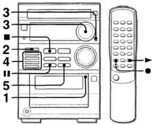 AIWA XRM35 - REMARQUE - 1