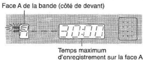 AIWA XRM35 - REMARQUE - 1