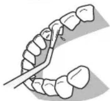 PANASONIC EWDJ10 - Parte posterior de los dientes... - 2