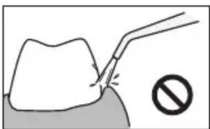 PANASONIC EWDJ10 - Tilde nedre tander - 2